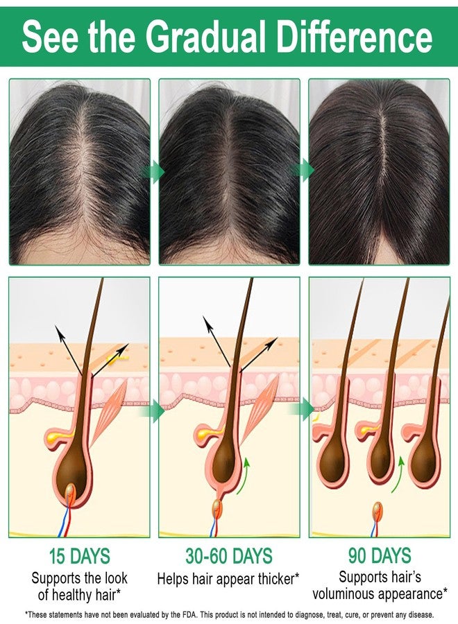 KITNOBLIS ‌Hair Growth Serum Roll-On with 3% Rosemary & Redensyl, 2% AnaGain, Professional Hair Regrowth Treatment for Thicker, Fuller Looking Hair (20 ML) - Image 5